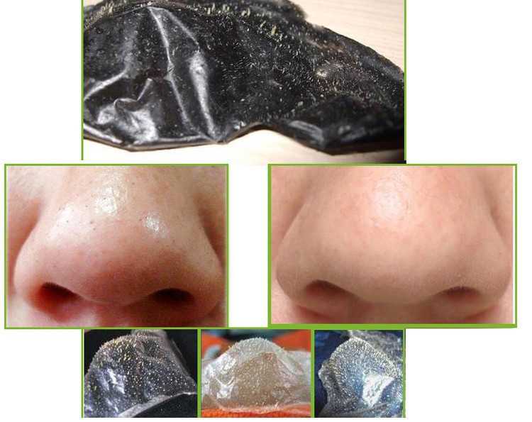 Как избавиться от черных точек на носу