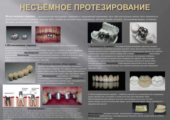 Стоит ли выбирать нейлоновый зубной протез? характеристики