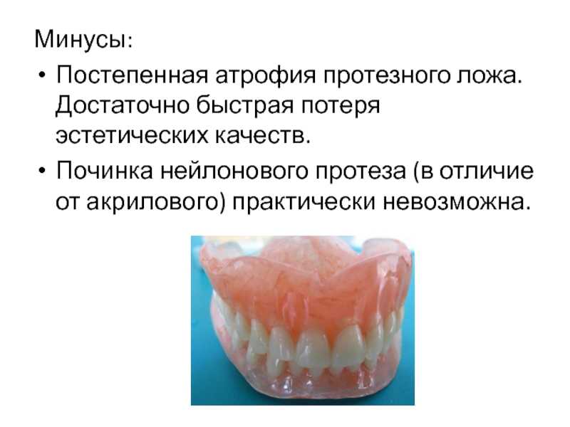Съемные зубные протезы: фото, цена, лучшие съемные зубные протезы, отзывы, как привыкнуть