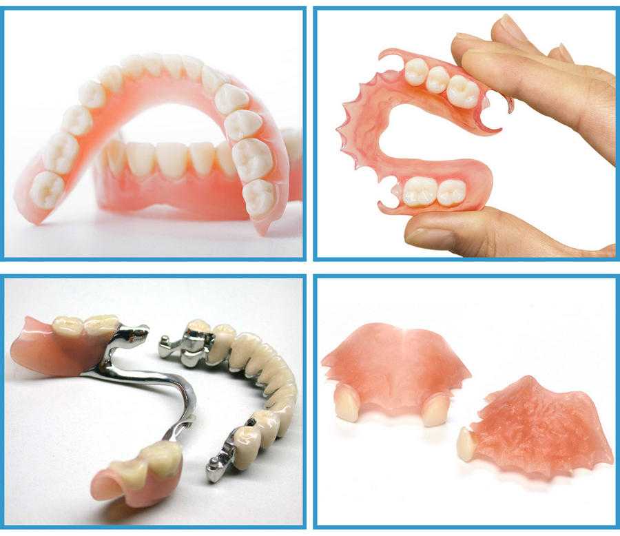 Съемные зубные протезы: как выбрать лучший вариант | стоматология 24