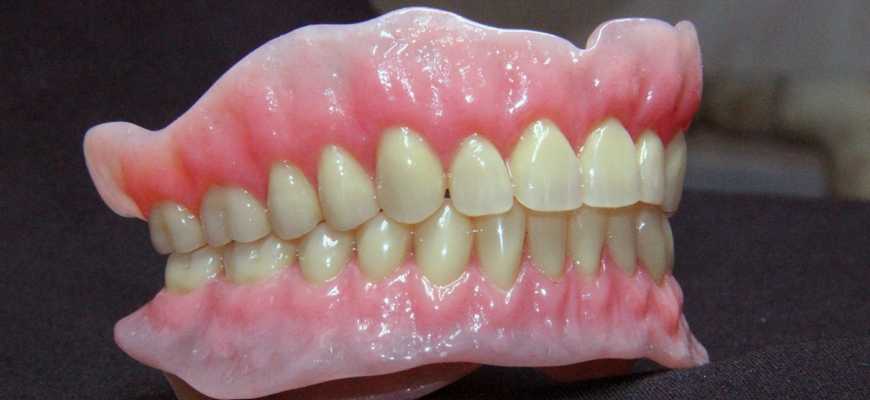 Съемные зубные протезы нейлоновые, цены, отзывы, недорого в клинике илатан
