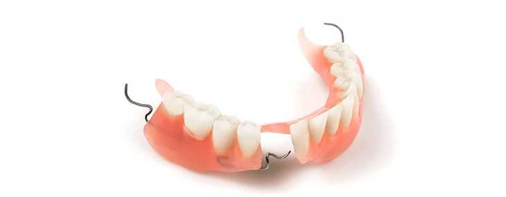 Нейлоновые зубные протезы: достоинства, недостатки, мнение стоматолога и отзывы пациентов, фото, цены.
