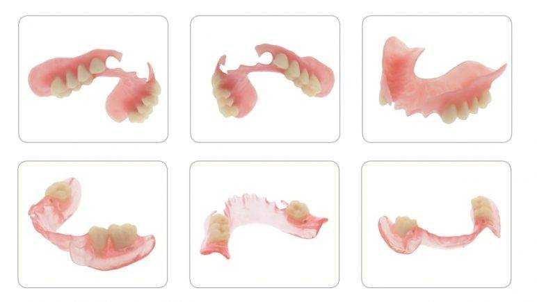 Нейлоновые зубные протезы: конструкция, плюсы и минусы, кому подойдут, уход, отличие от других видов протезов