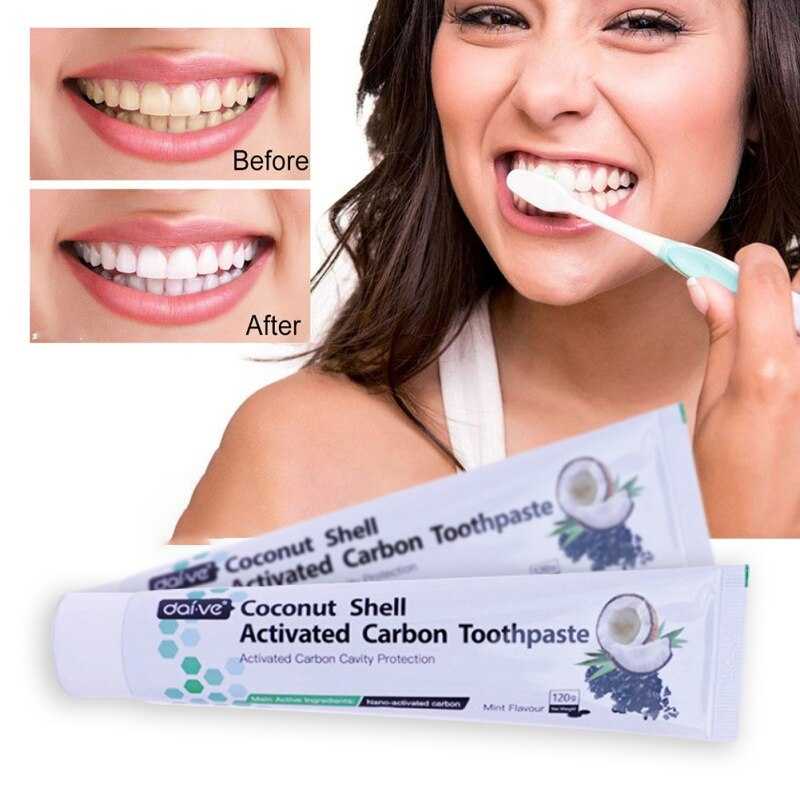 Отбеливающие зубные пасты: рейтинг самых лучших паст для отбеливания зубов, эффективные японские и другие пасты, профессиональные, отзывы