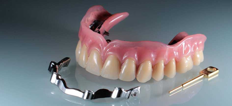 Clinicin.ru | вы планируете протезирование зубов. что нужно знать об этом еще до консультации стоматолога?
