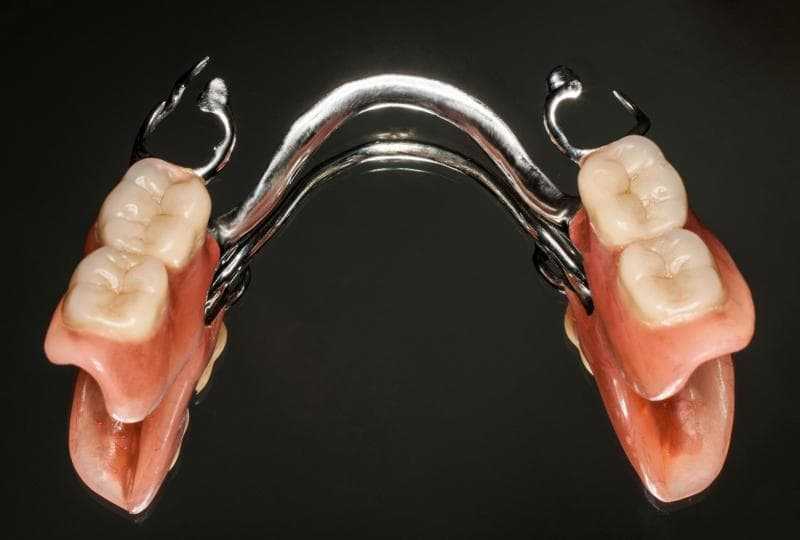 Протезирование зубов недорого: по полису омс, недорогие съемные протезы, недорогие несъемные протезы