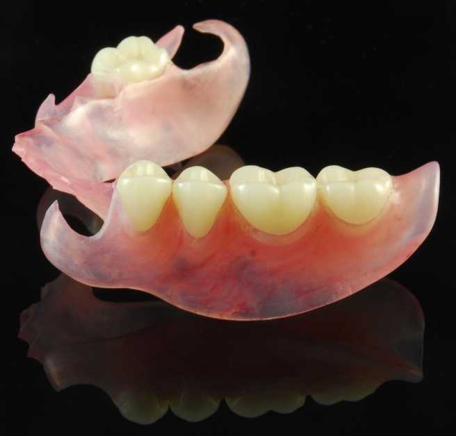 Съемные зубные протезы — цена протезирования в москве, стоимость съемных протезов в стоматологическом центре «стомос»