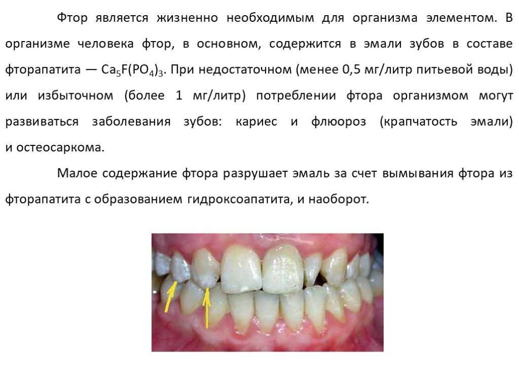 Отрицательный фтор. Недостаток фтора в организме зубы. Избыток фтора в организме зубы. Дефицит фтора в организме.
