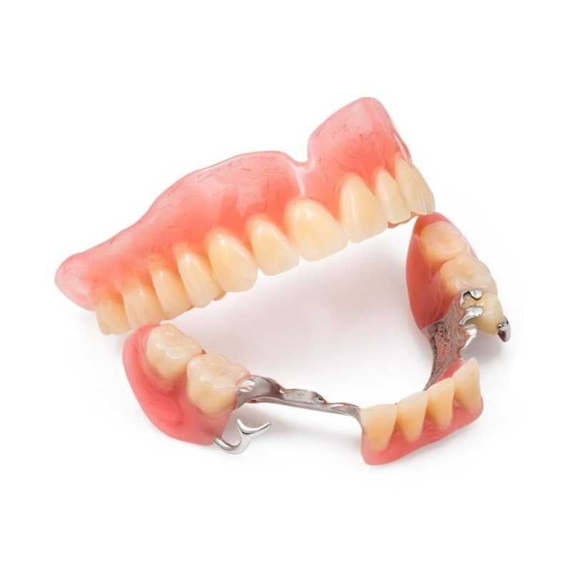 Этапы протезирования зубов | сеть стоматологических клиник зуб.ру