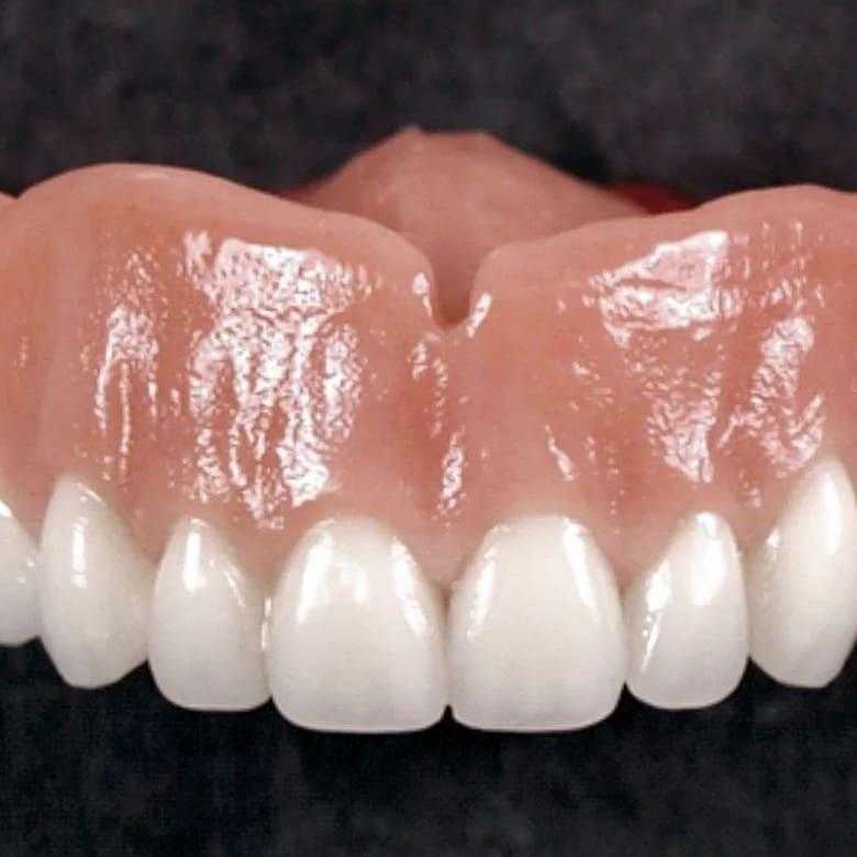 Акриловые зубные протезы | цены на съемные акриловые протезы зубов в москве