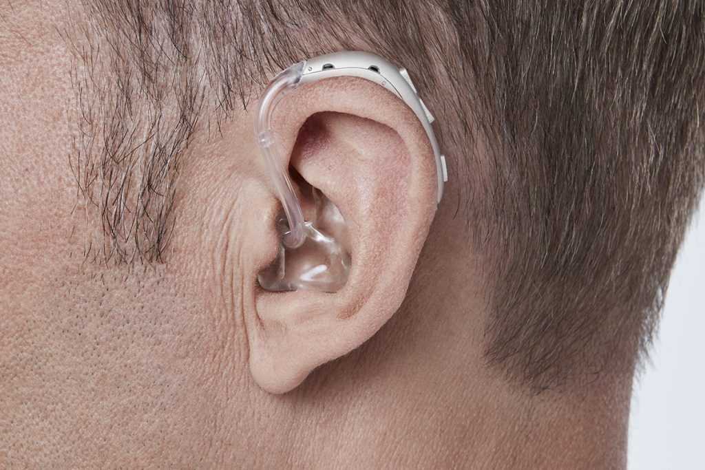 Топ-13 лучших слуховых аппаратов: выбираем лучший звукоусиливающий прибор