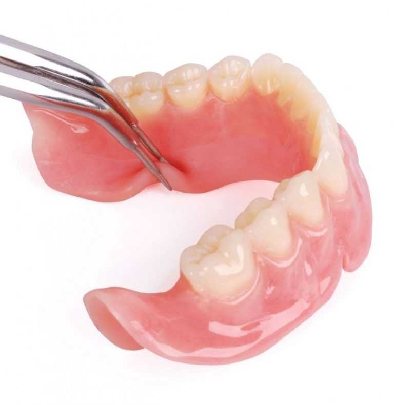 Съемные зубные протезы — цена протезирования в москве, стоимость съемных протезов в стоматологическом центре «стомос»
