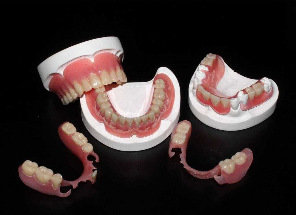 Какие протезы зубов лучше поставить. сравнение особенностей, отзывы, цены
