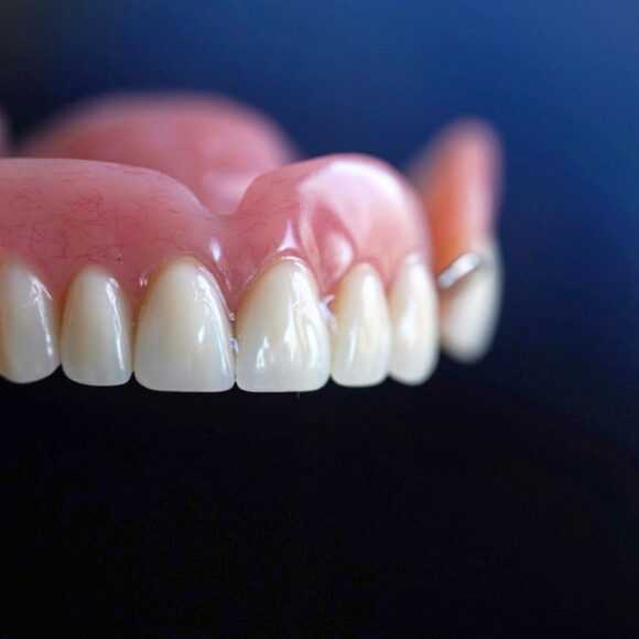 Зубные протезы из акриловой пластмассы. преимущества и недостатки