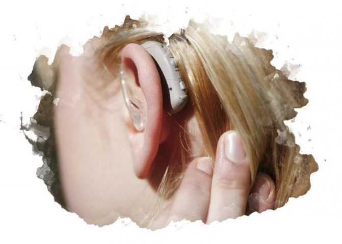 Лучшие слуховые аппараты - рейтинг 2021 года: обзор цен, отзывы