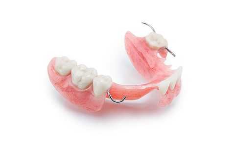 Какие зубные протезы лучше?
